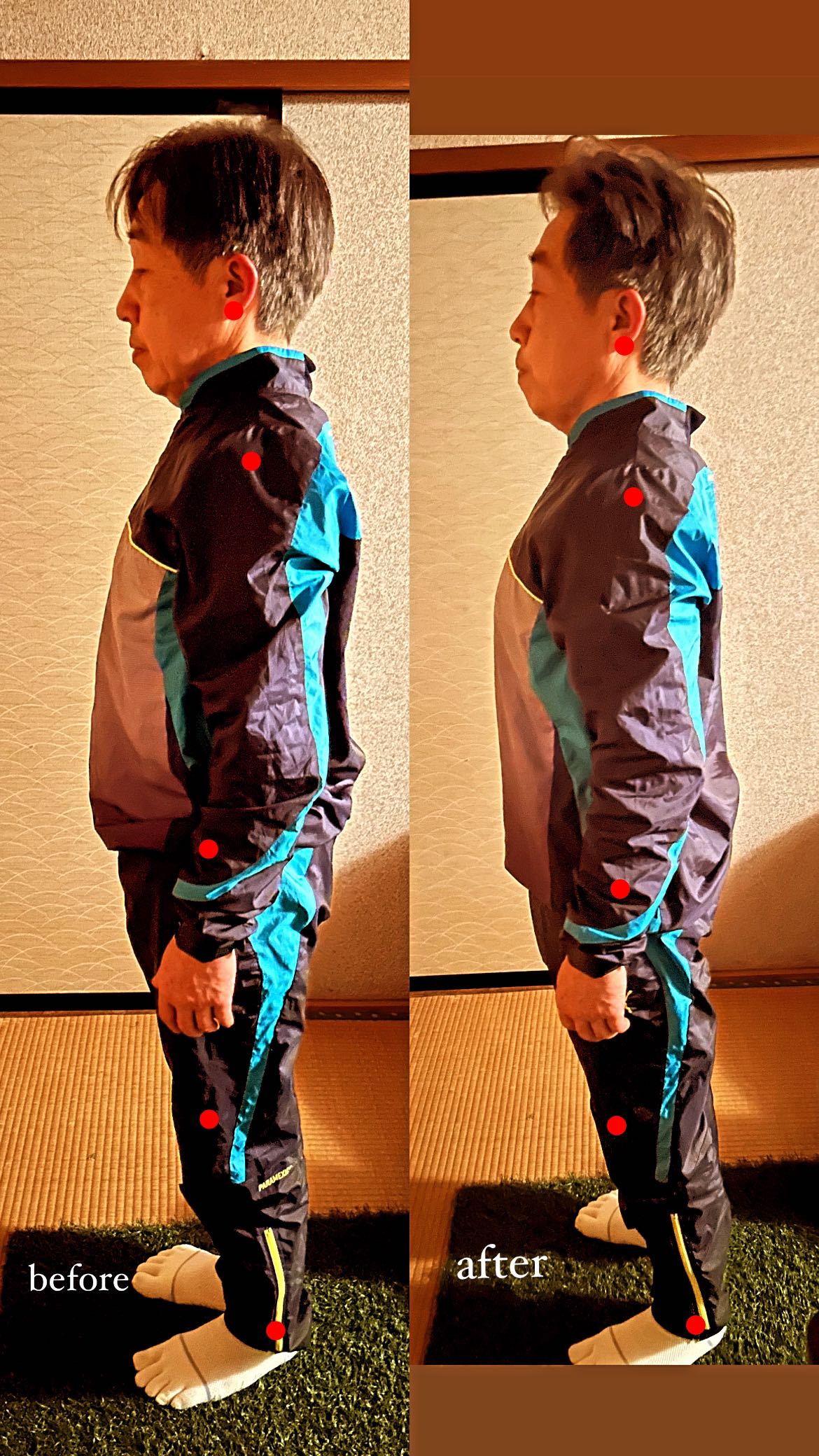 ビフォーアフター