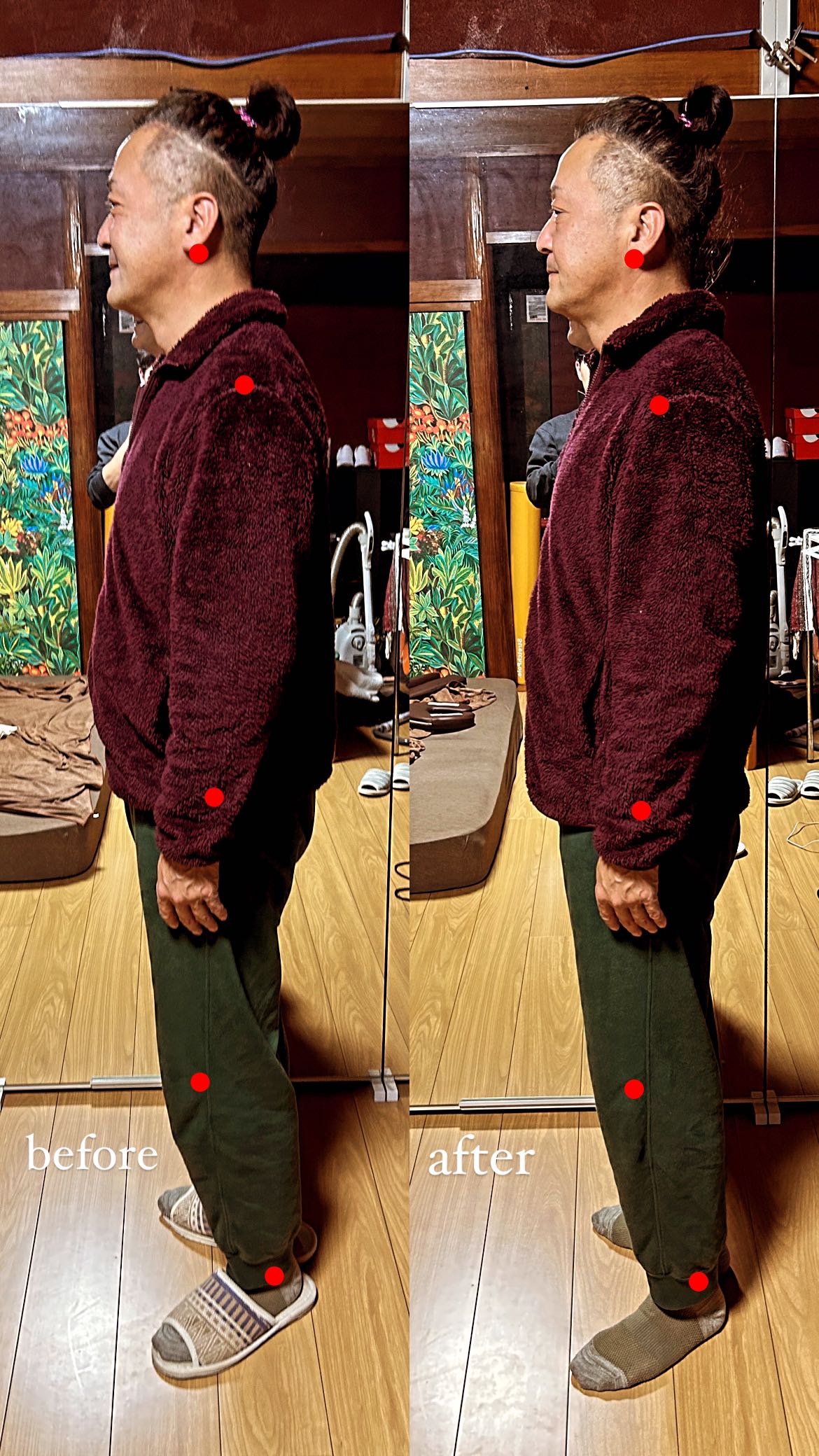 ビフォーアフター